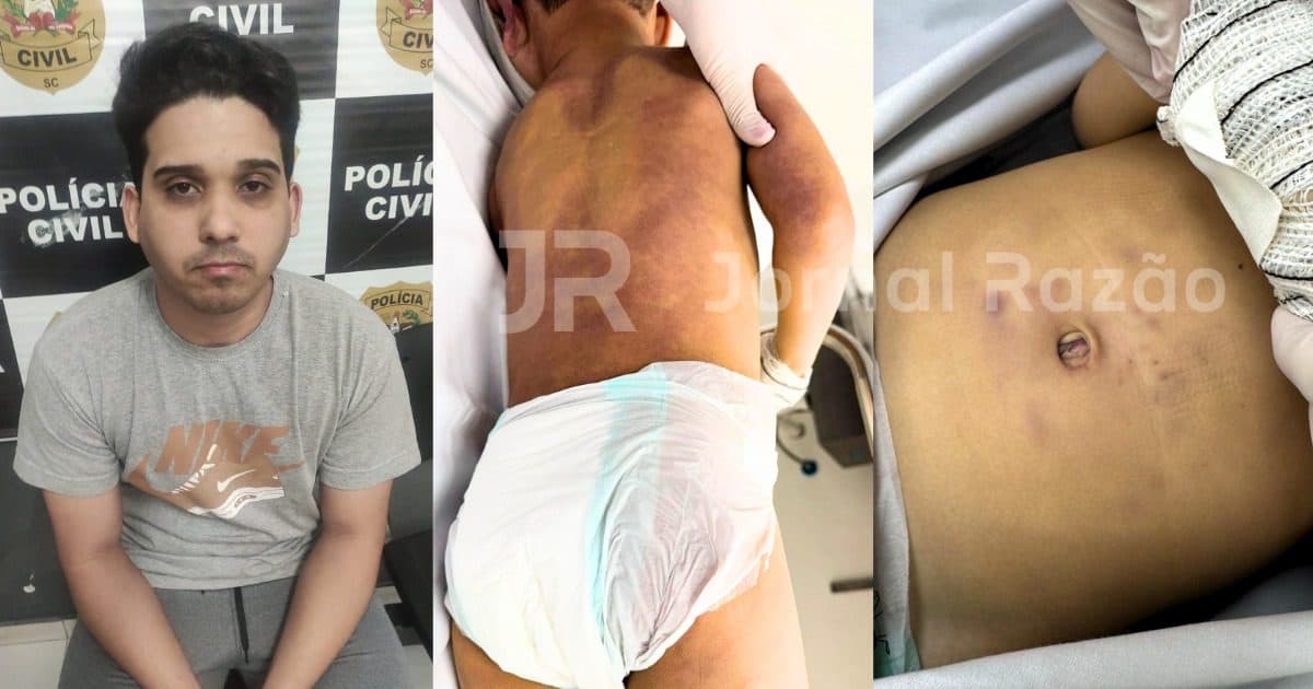 EXCLUSIVO: Marcas nas costas, mordida na bochecha, socos no abdômen: a morte cruel de Moisés em SC