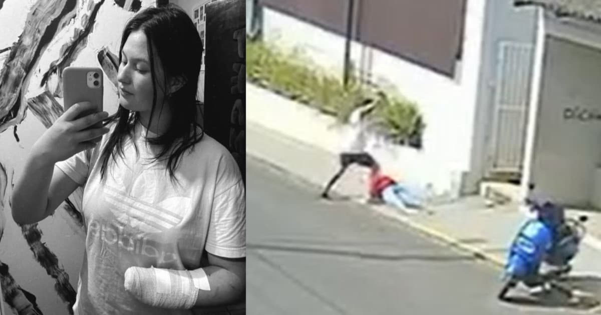 “Senhor, me deixa com a minha mão”: jovem atacada pelo ex com facão em SC faz desabafo emocionante