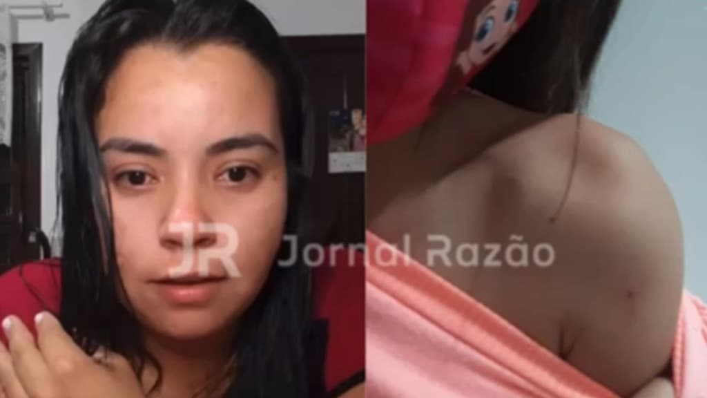 “Mãe, ela colocou a agulha em mim”: enfermeira “fura” criança com seringa de paciente com doença sexual