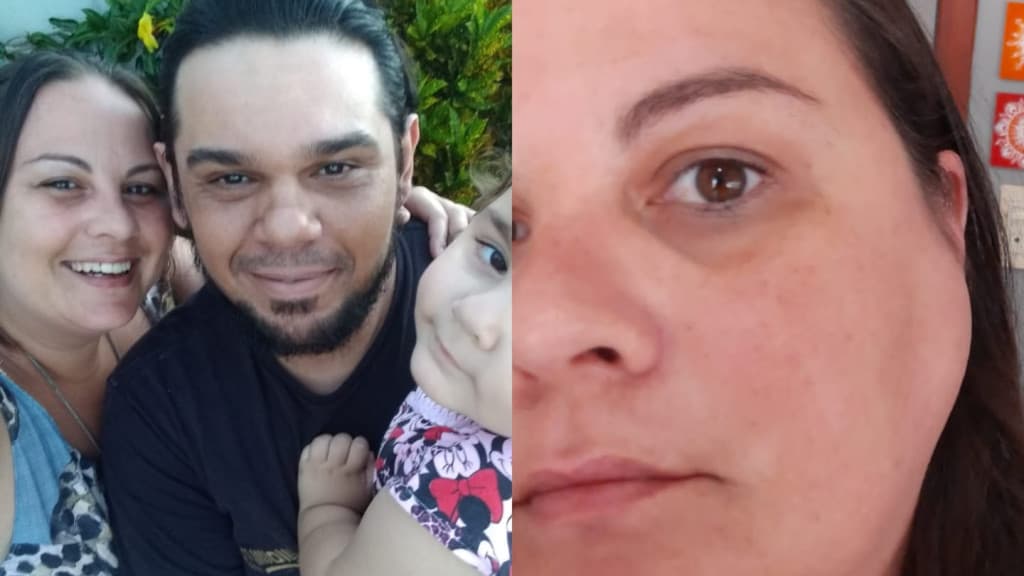 Lutando contra a dor e o tempo: Moradora de Tijucas clama por ajuda para cirurgia de tumor