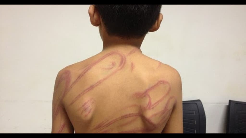 Criança é espancada pelo avô por não saber jogar bola