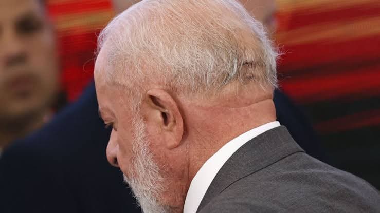 Lula é submetido a cirurgia de emergência no cérebro e está na UTI