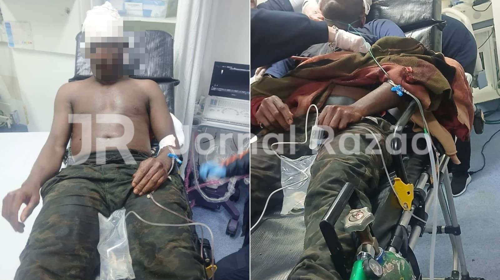 Homem é brutalmente atacado em Criciúma e chega ao hospital em estado critico: “golpes na cabeça”