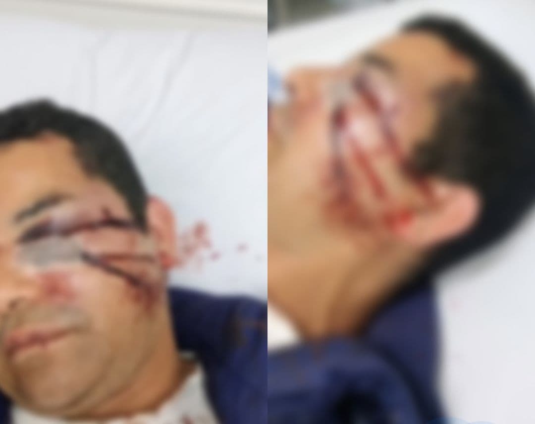 “Voz de bichinha”: morador de Florianópolis diz ter sido espancado por assaltantes homofóbicos