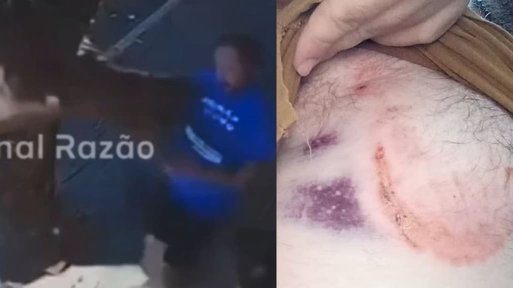 VÍDEO: Burro morde vereador que caminhava por rua no Paraná