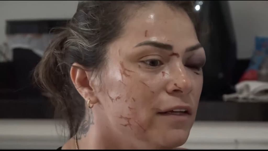 Mulher se revolta após ser espancada pelo ex-marido, em SC