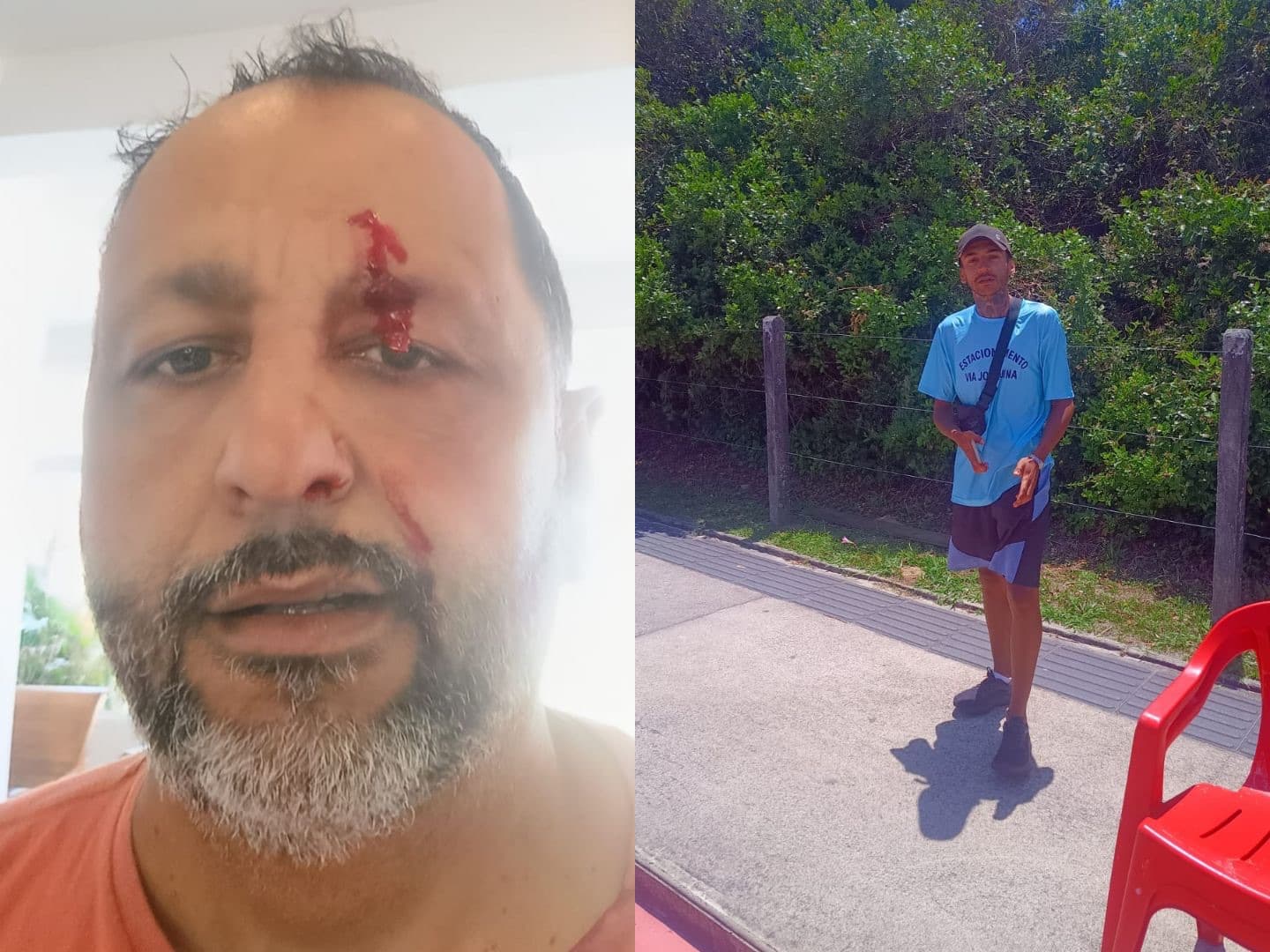 Motorista diz ter sido agredido após se recusar a pagar flanelinha em praia de Florianópolis