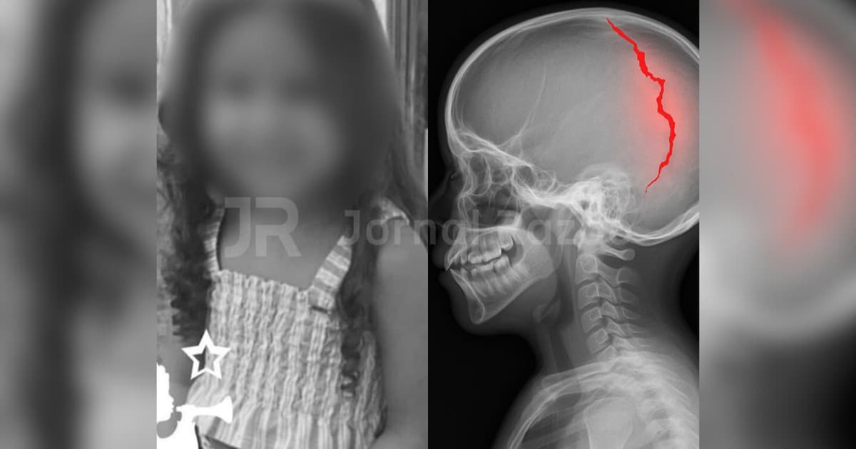 “Cachorro empurrou”: morre menina de 4 anos levada ao hospital pelo padrasto em SC
