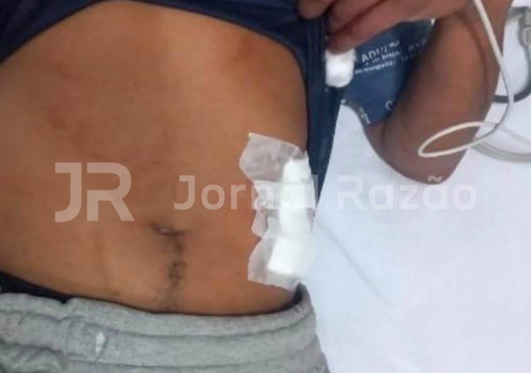 Homem leva três tiros para não entregar celular em assalto em Florianópolis