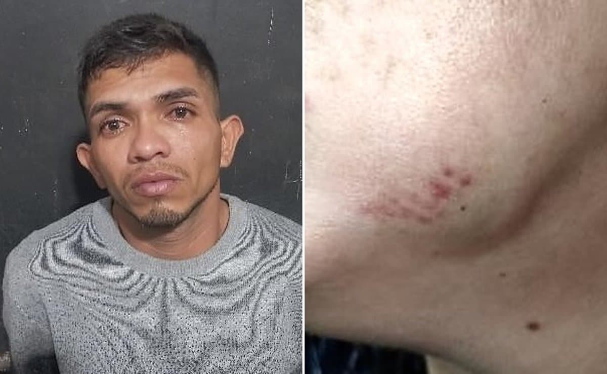 “Vampiro do Pará” é preso depois de morder o rosto da esposa em Navegantes