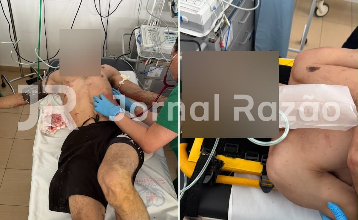 PMSC procura dupla em moto que esfaqueou jovem pelas costas no Vale do Rio Tijucas